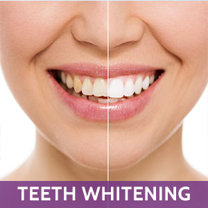 Teeth Whitening in Farmingtong