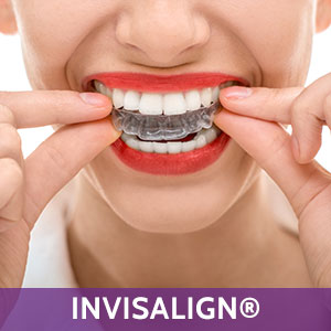 Invisalign in Farmington